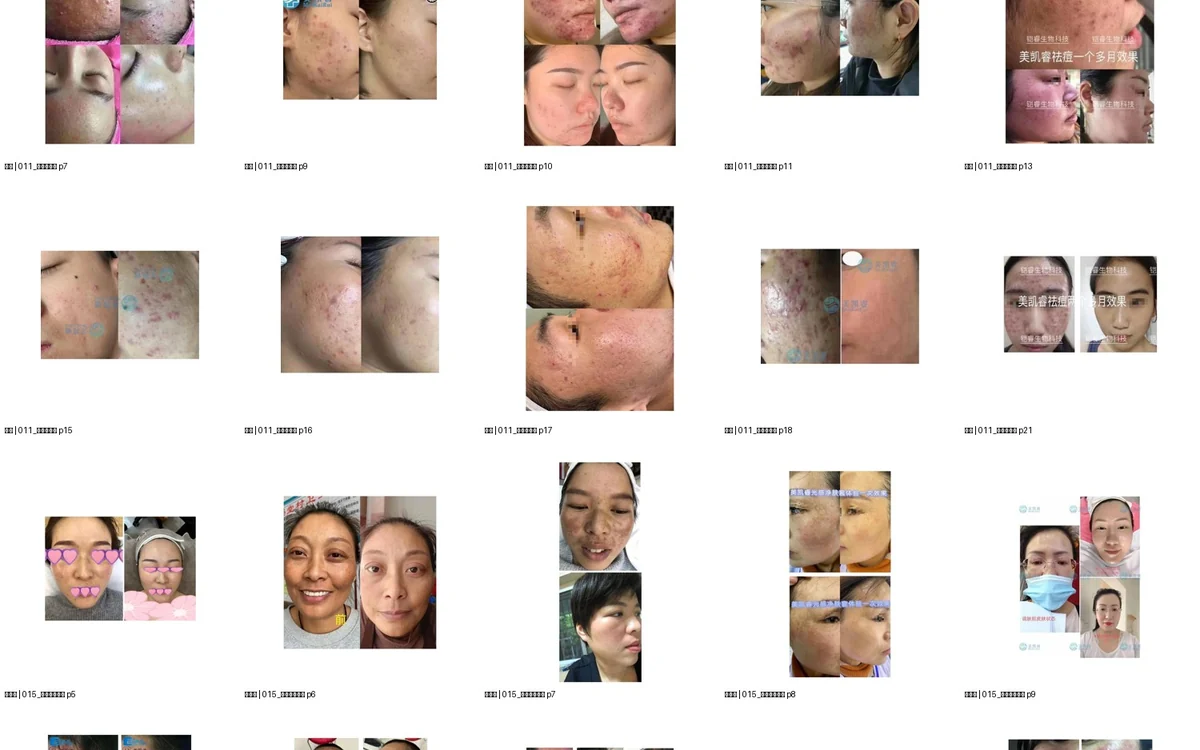 护理记录怎么拍才有参考价值：光线、角度与时间线